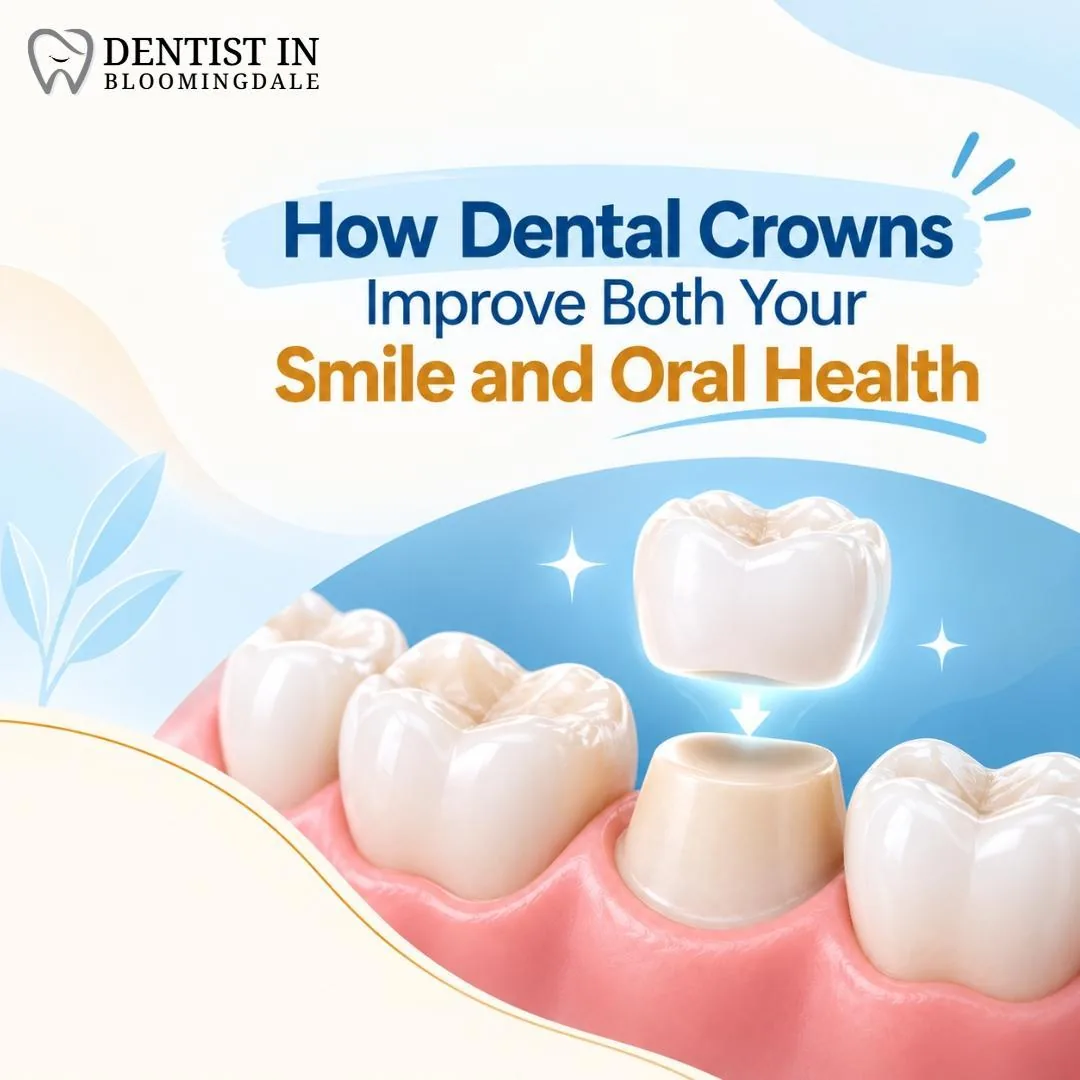 How Dental Crowns Improve Both Your Smile And Oral Health