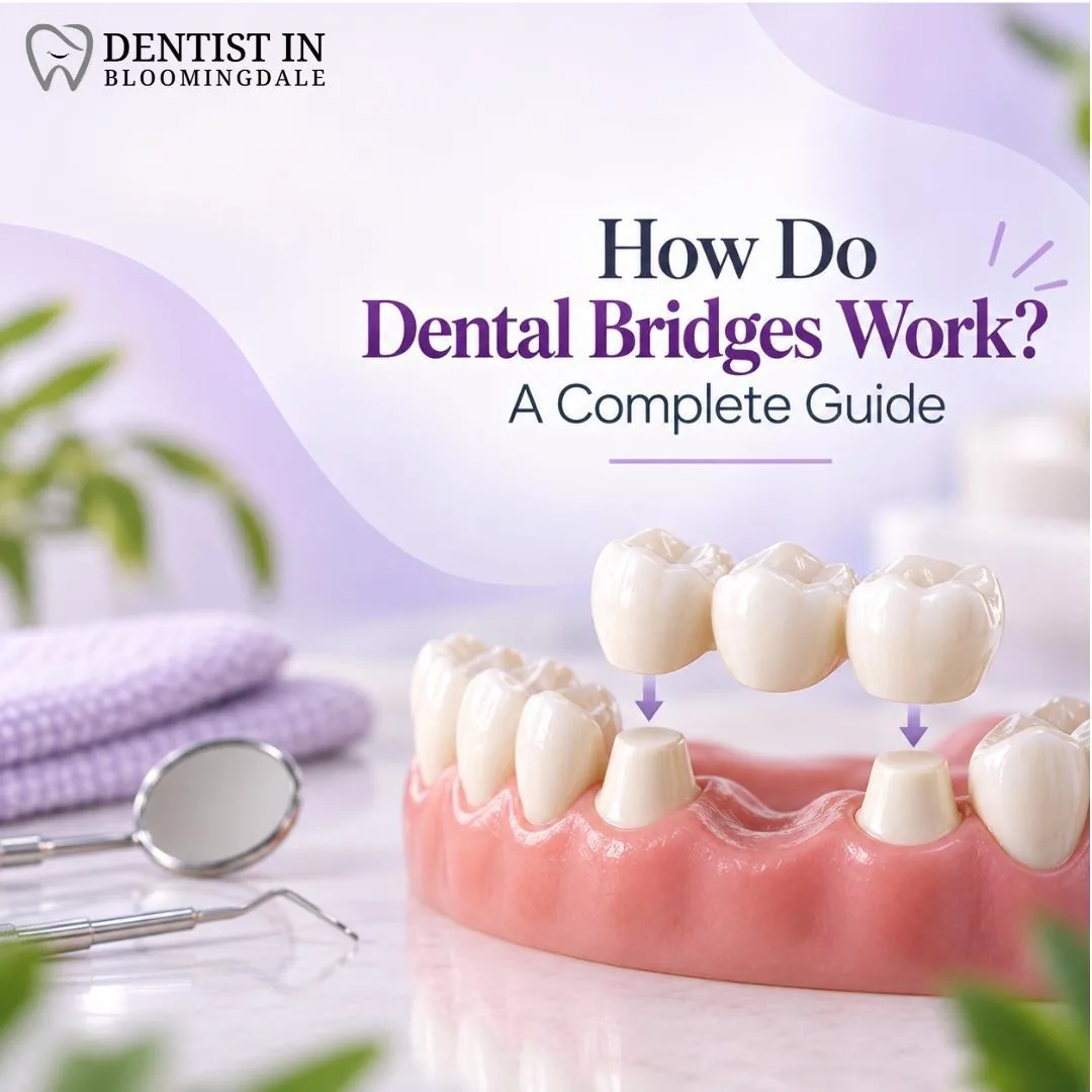 How Do Dental Bridges Work? A Complete Guide