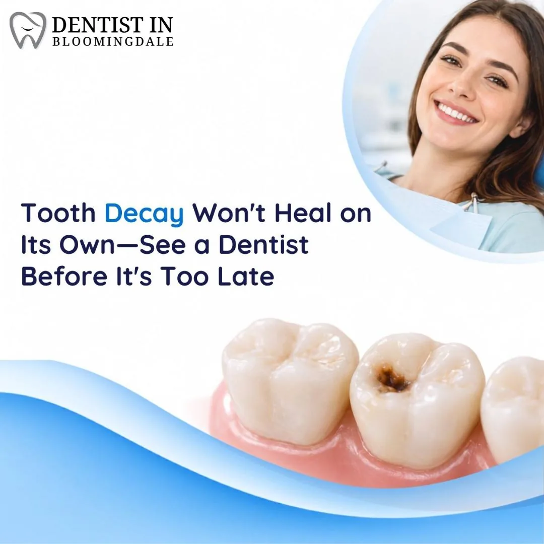 Tooth Decay Won't Heal on Its Own—See a Dentist Before It's Too Late Many people feel a sharp twinge when they bite. They spot a dark spot on a tooth and worry. Tooth Decay can start small but grow fast. This causes pain, cavities, and damage to tooth enamel. It can hurt dental health and oral care routines.